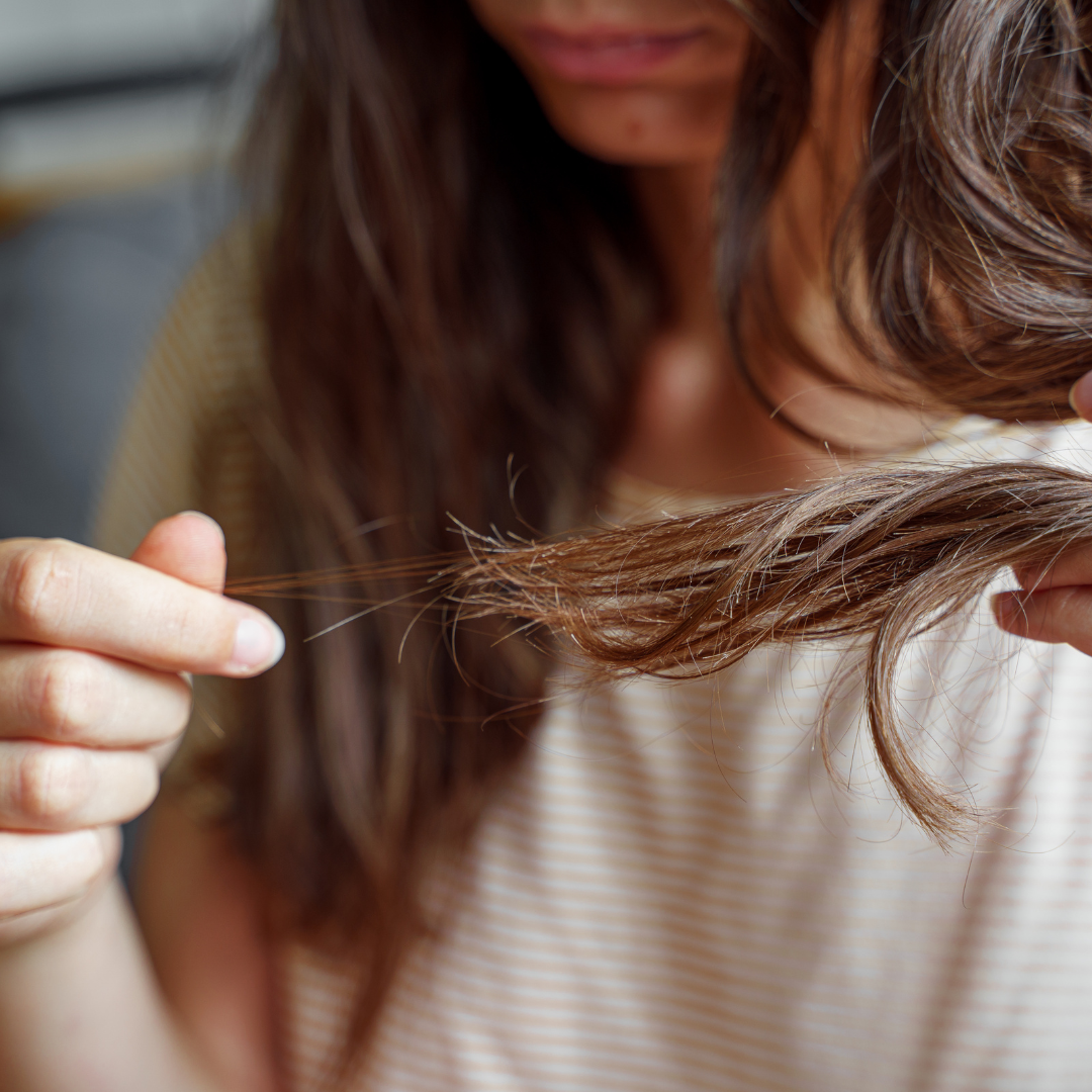 The Surprising Signs of Low Iron Levels You Shouldn’t Ignore